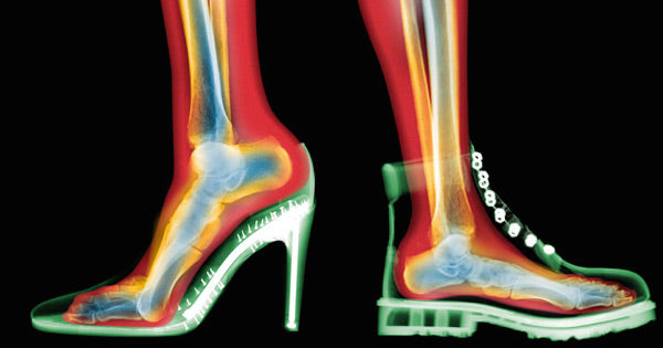 How Shoes Hurt You & Why Standing Barefoot is Healthier